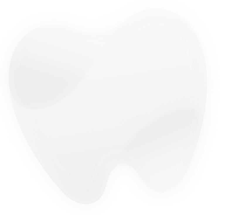Upper and Lower Milled All-On-X bridges - Dental Implant Solutions